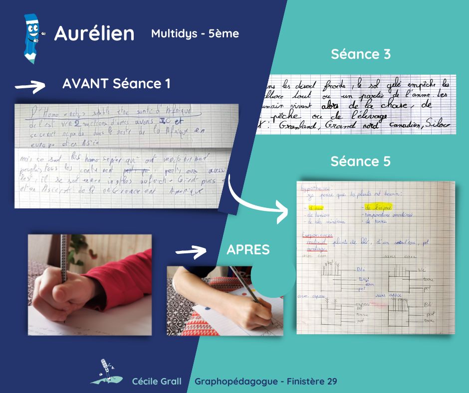 Avril 2021 - Aurélien, 12 ans, en 5ème